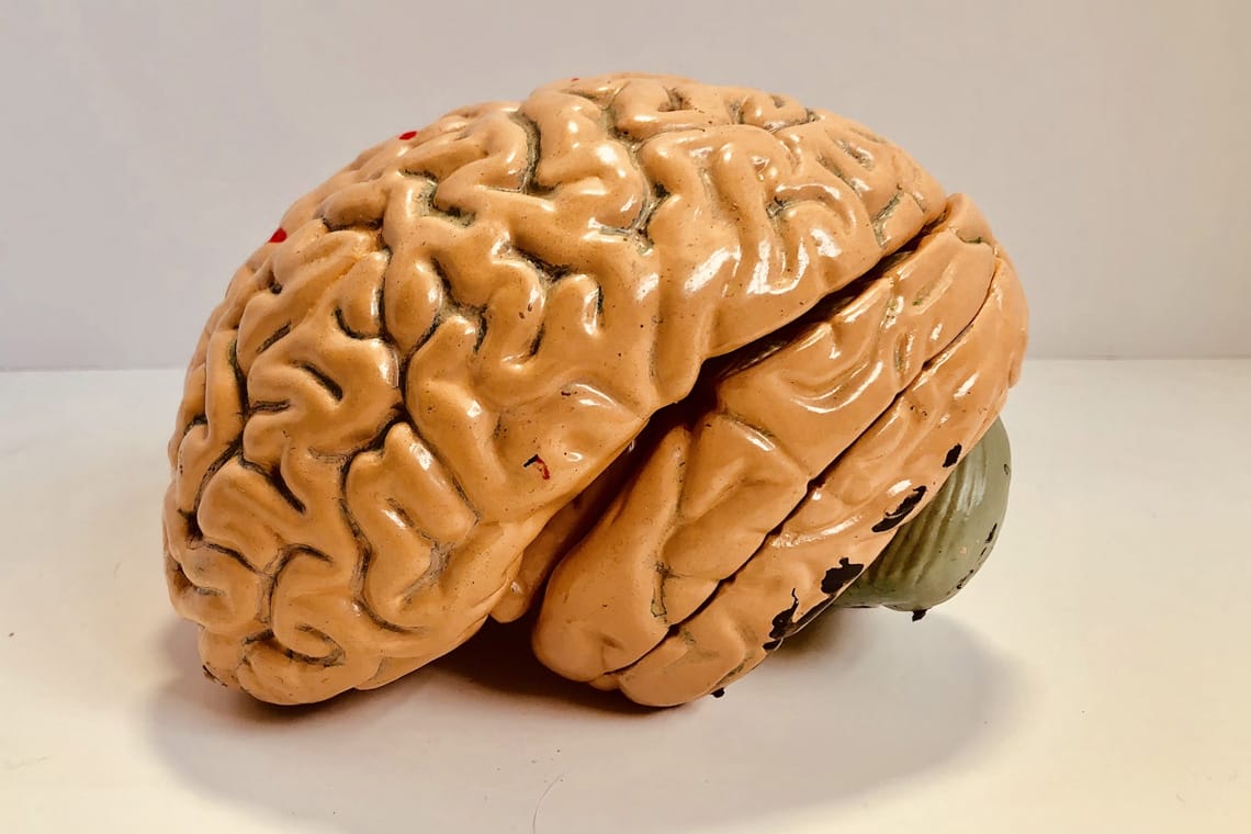 London Psychology Trip brain